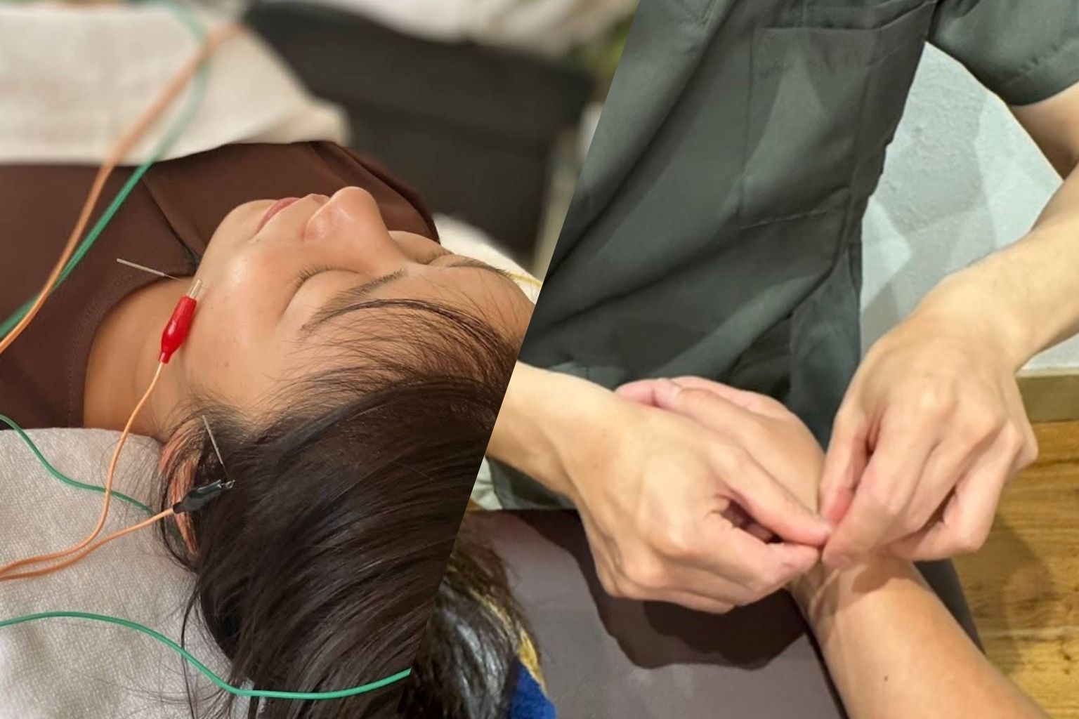 おののはり。美容鍼からだの鍼。リラクゼーション。北九州戸畑区